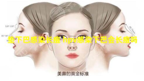 垫下巴感染长痘 hpv感染下巴会长痘吗